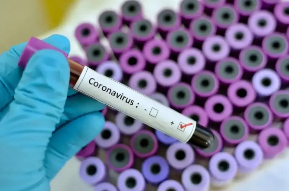 ¡Continúa el aumento de casos en la Región de Murcia! 340 nuevos positivos y una fallecida por Covid-19