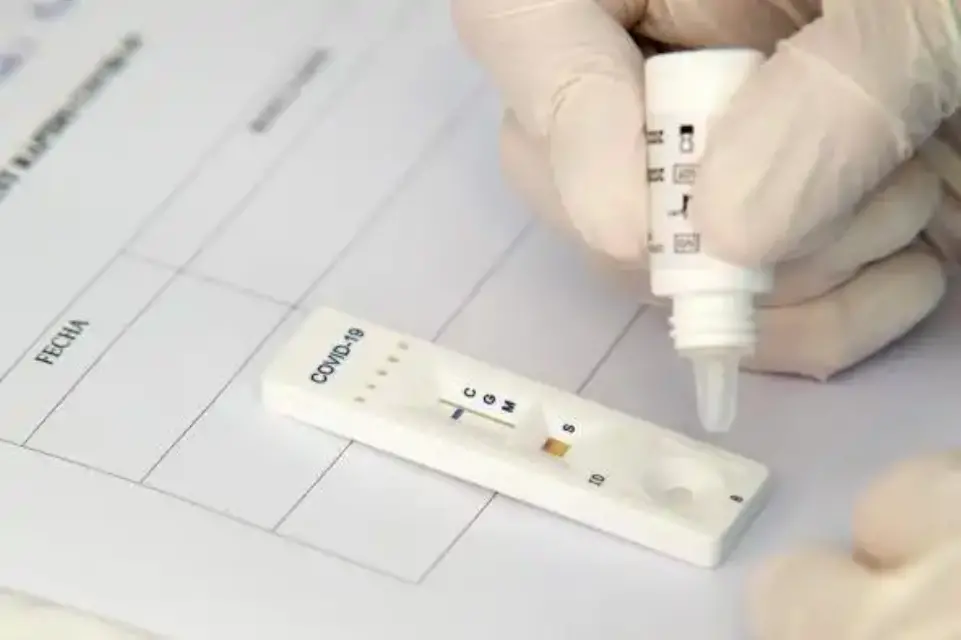 Salud registra 303 nuevos casos de coronavirus en las últimas 24 horas