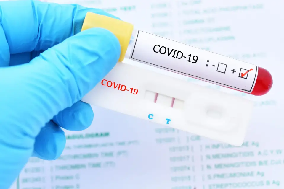Consejería de Salud informa 281 nuevos casos de coronavirus y más de 50 ingresos hospitalarios en las últimas 24 horas