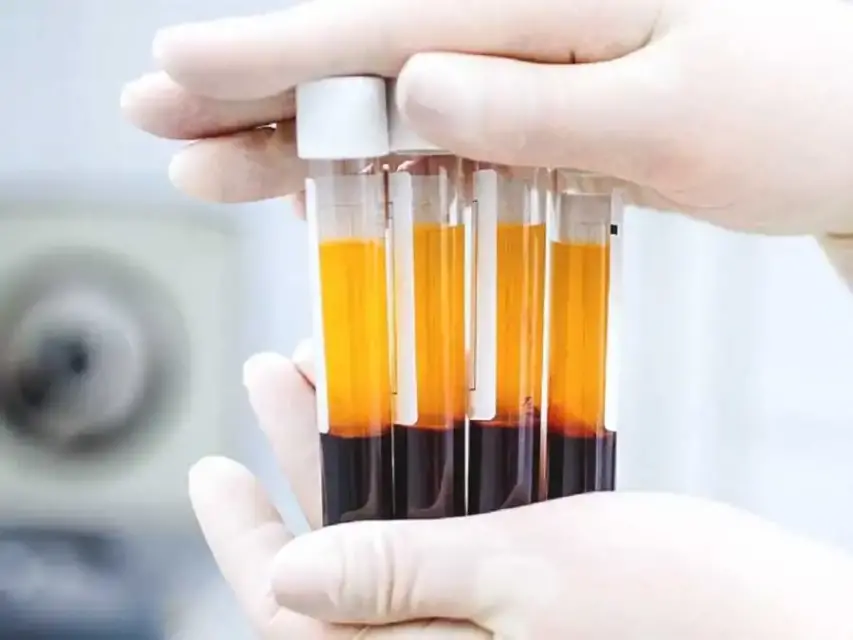 Descubren que el plasma sanguíneo de supervivientes de Covid-19 reduce los síntomas graves de esta infección