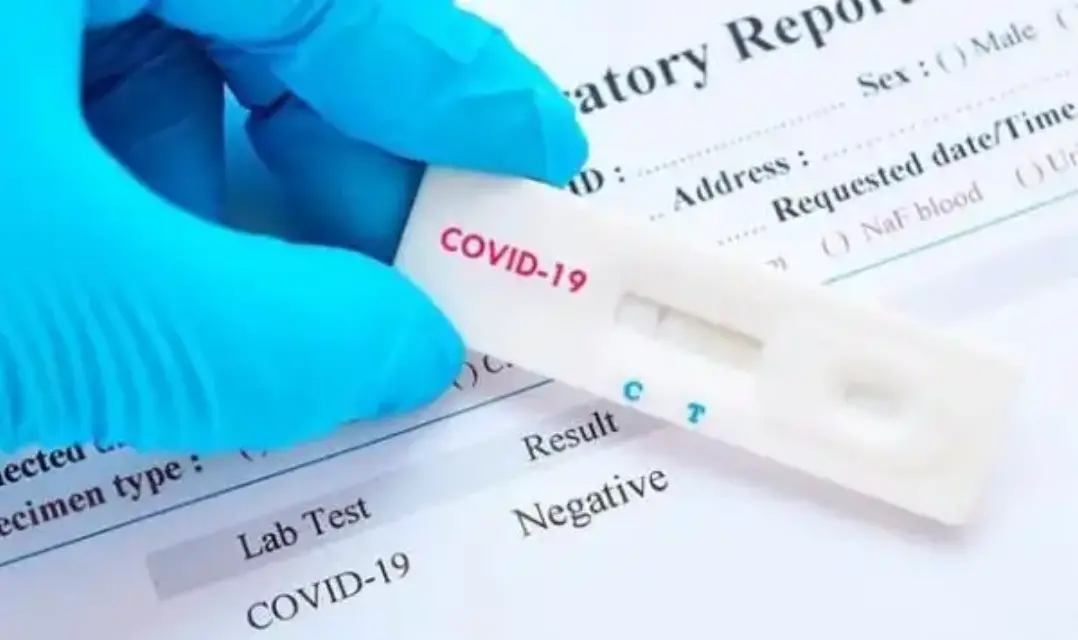 La incidencia de contagios por Covid-19 baja en la Región y Salud apuesta por más puntos para test de antígenos